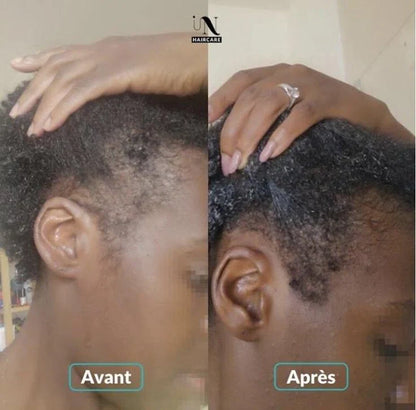 Sérum roll-on pour la croissance des cheveux