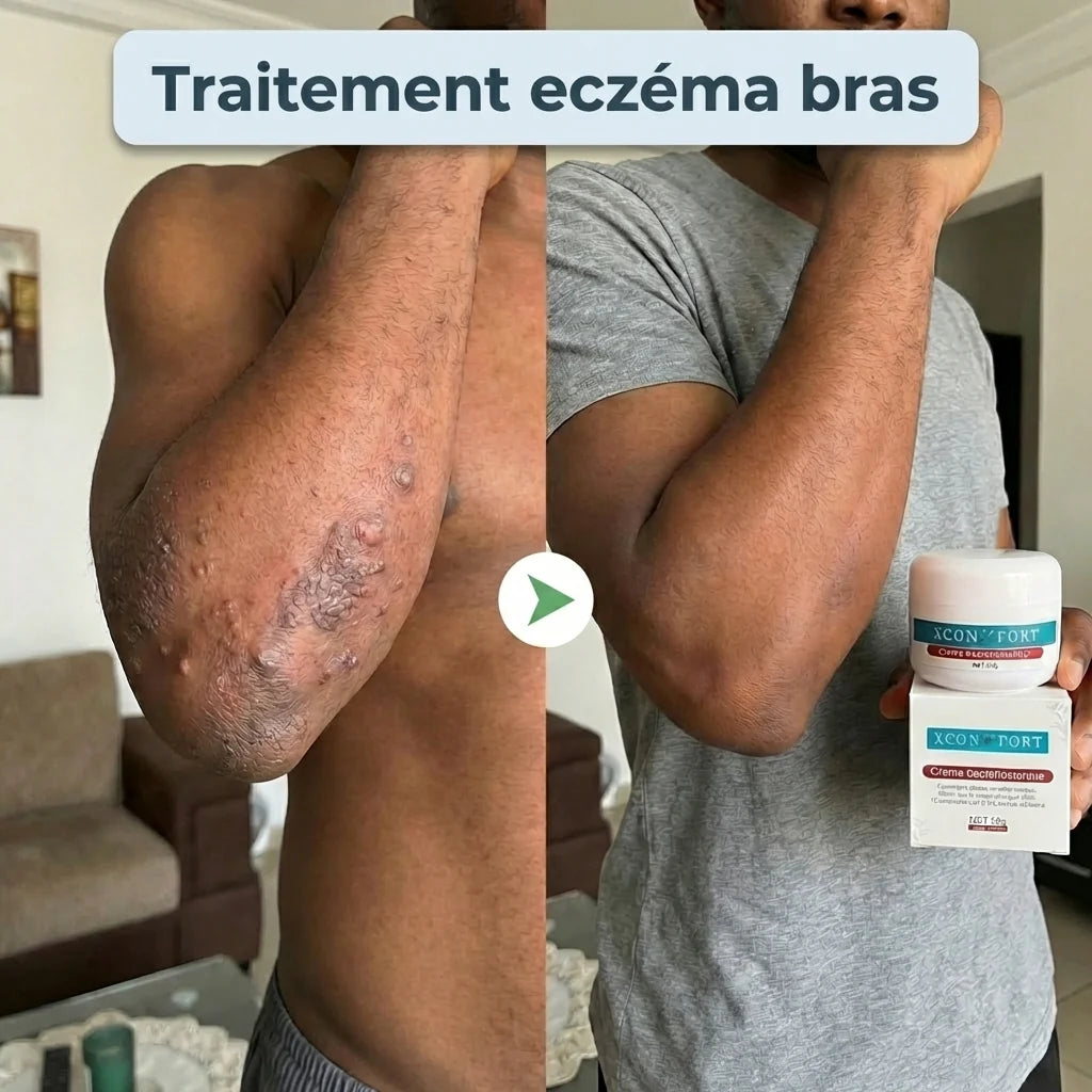 X-CONFORT - CRÈME TRAITEMENT POUR LA PEAU