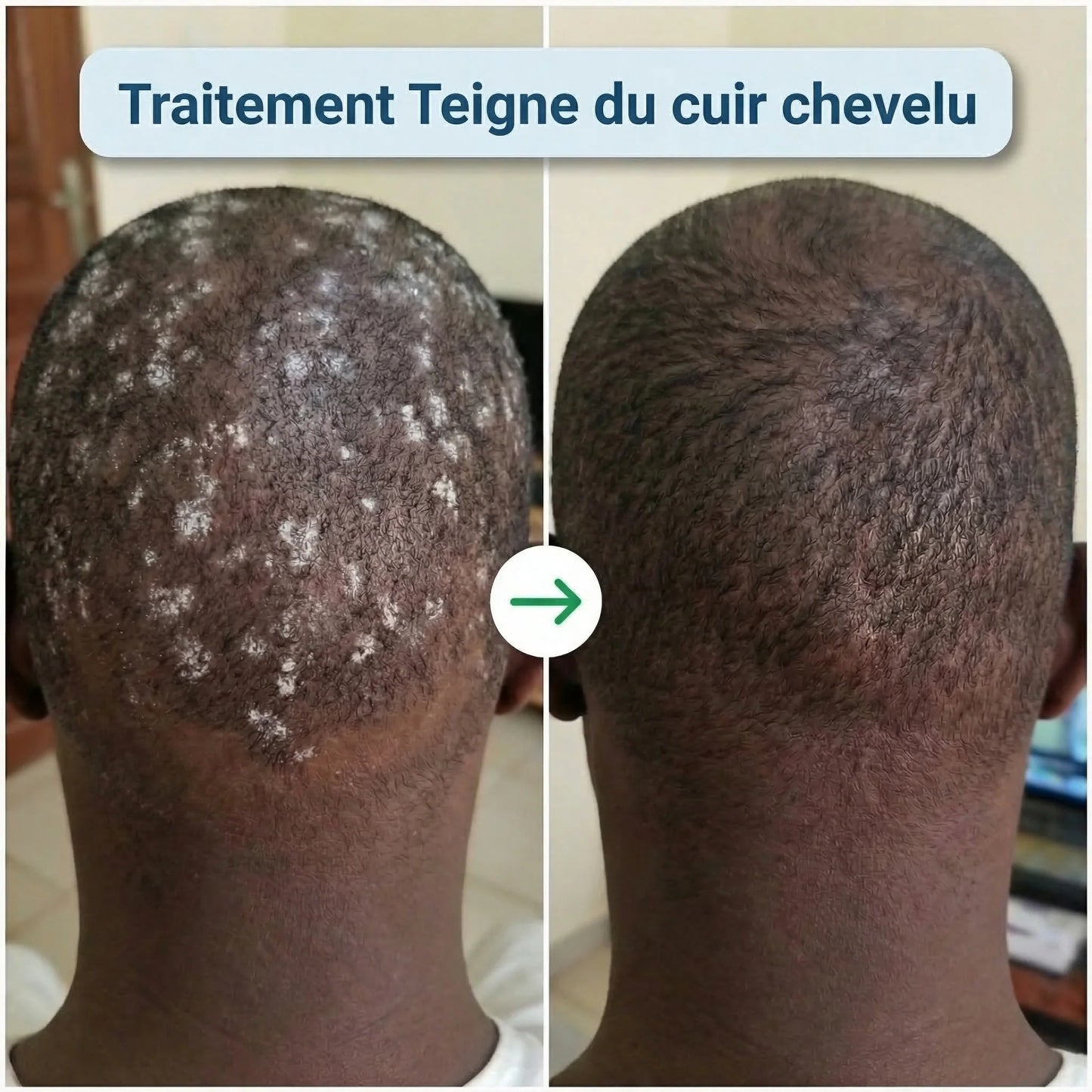 X-CONFORT - CRÈME TRAITEMENT POUR LA PEAU